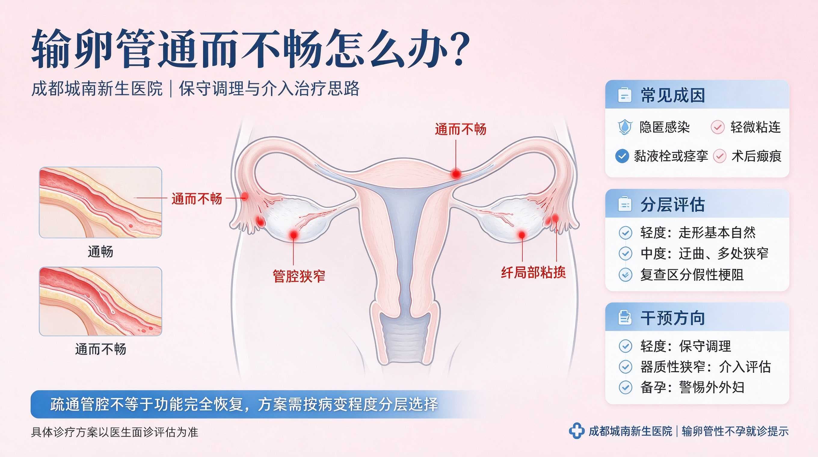 成都输卵管通而不畅怎么办？-- 保守调理与手术治疗思路--成都城南新生医院