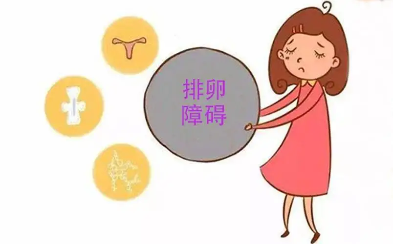 排卵障碍导致不孕该怎么才能治好