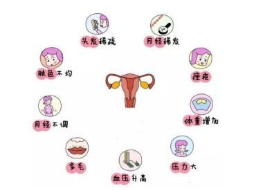 这些因素容易引起多囊卵巢综合征，一定要警惕
