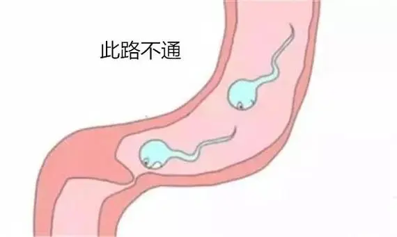 男性输精管不通有哪些明显的症状