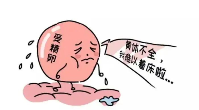 黄体功能不全六大因素